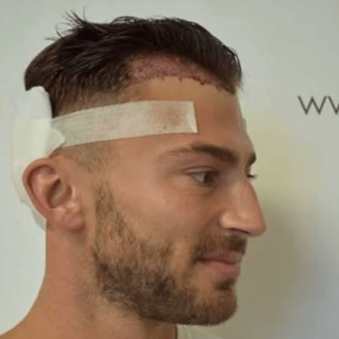 Close-up of a treated scalp area