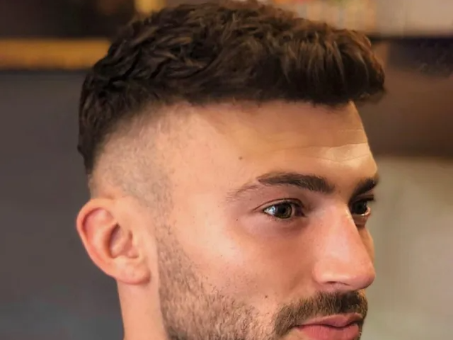 Jake Quickenden's hairline after his FUE hair transplant with Dr Matee