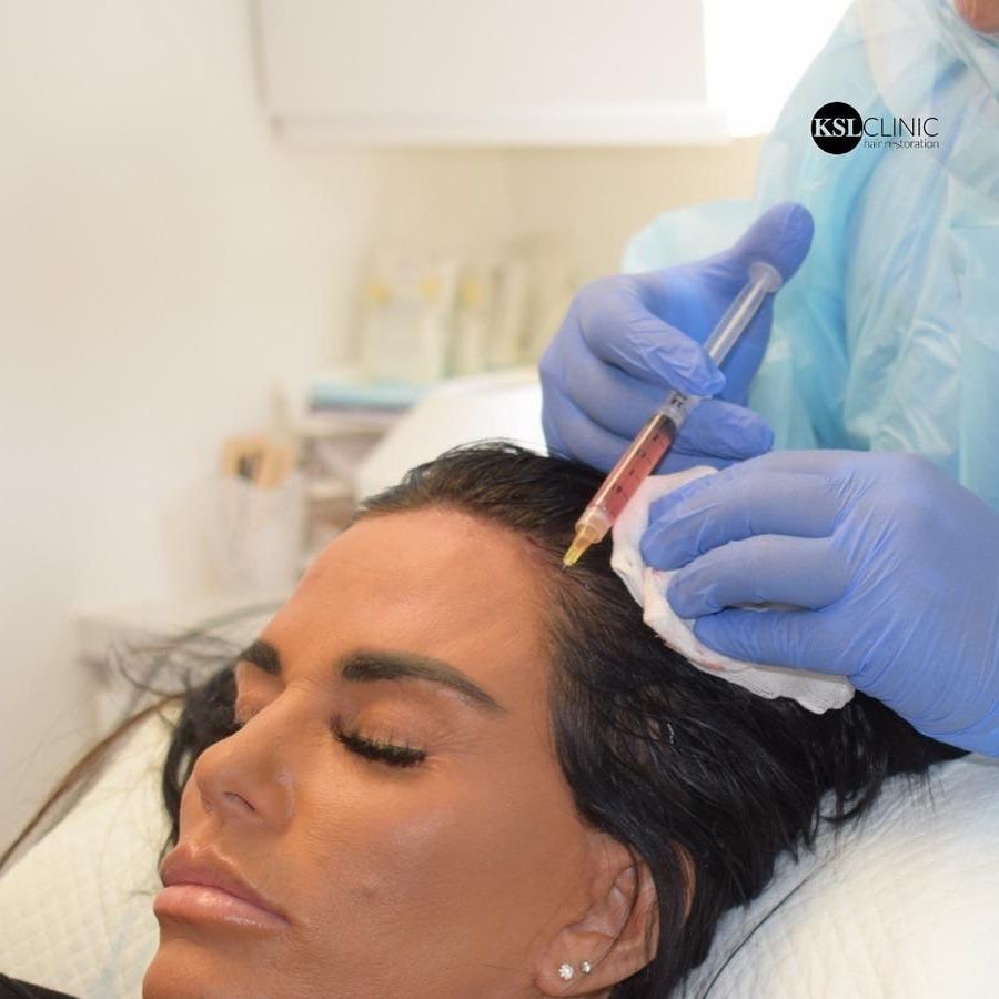 Platelet-rich plasma being injected at the hairline